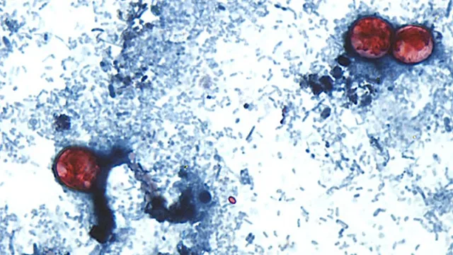 Parasita Cyclospora: A Batalha contra a Infecção