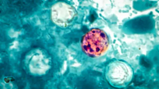 Ciclospora: Epidemia Muito Perigosa Afeta Mais de 400 Pessoas